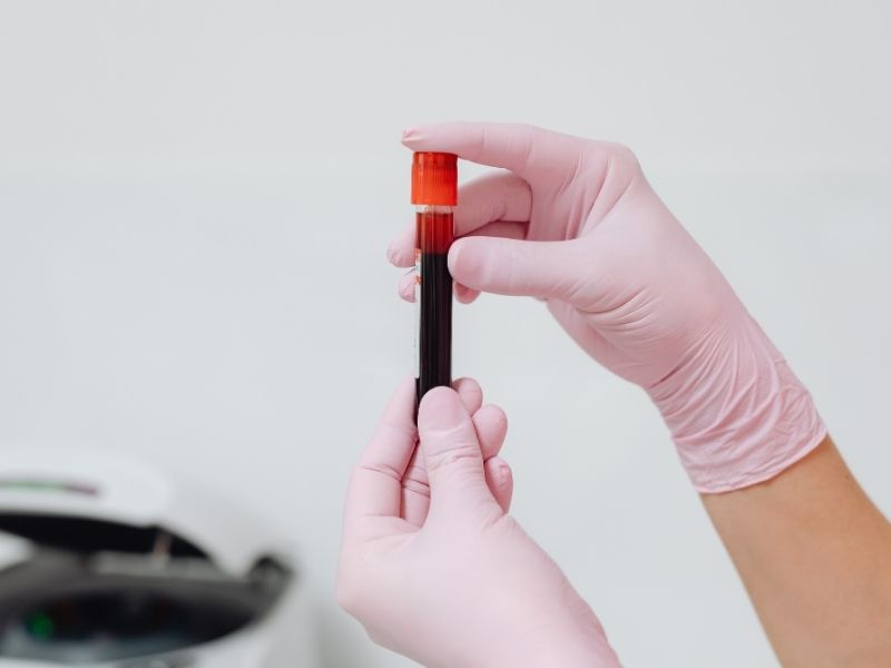 hormon-kan-testleri-ne-zaman-gereklidir